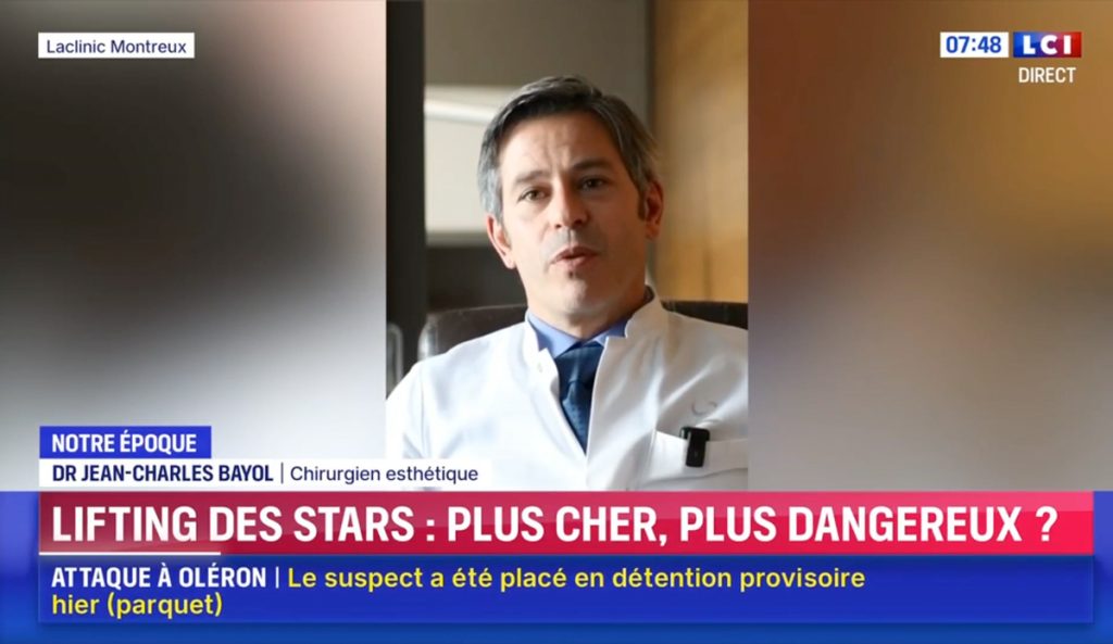 明星御用拉皮术，深层筋膜拉皮术